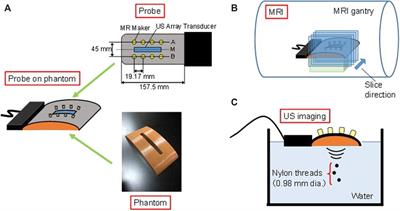 Preliminary Investigation of Magnetic Resonance Imaging Guided Beamforming in Flexible Type Ultrasonic Array Transducers